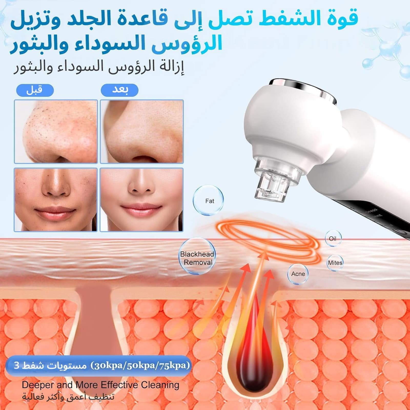 جهاز إزالة الرؤوس السوداء وشفط المسام مع 3 مستويات من الشفط - مزيلات العرق - صورة 5