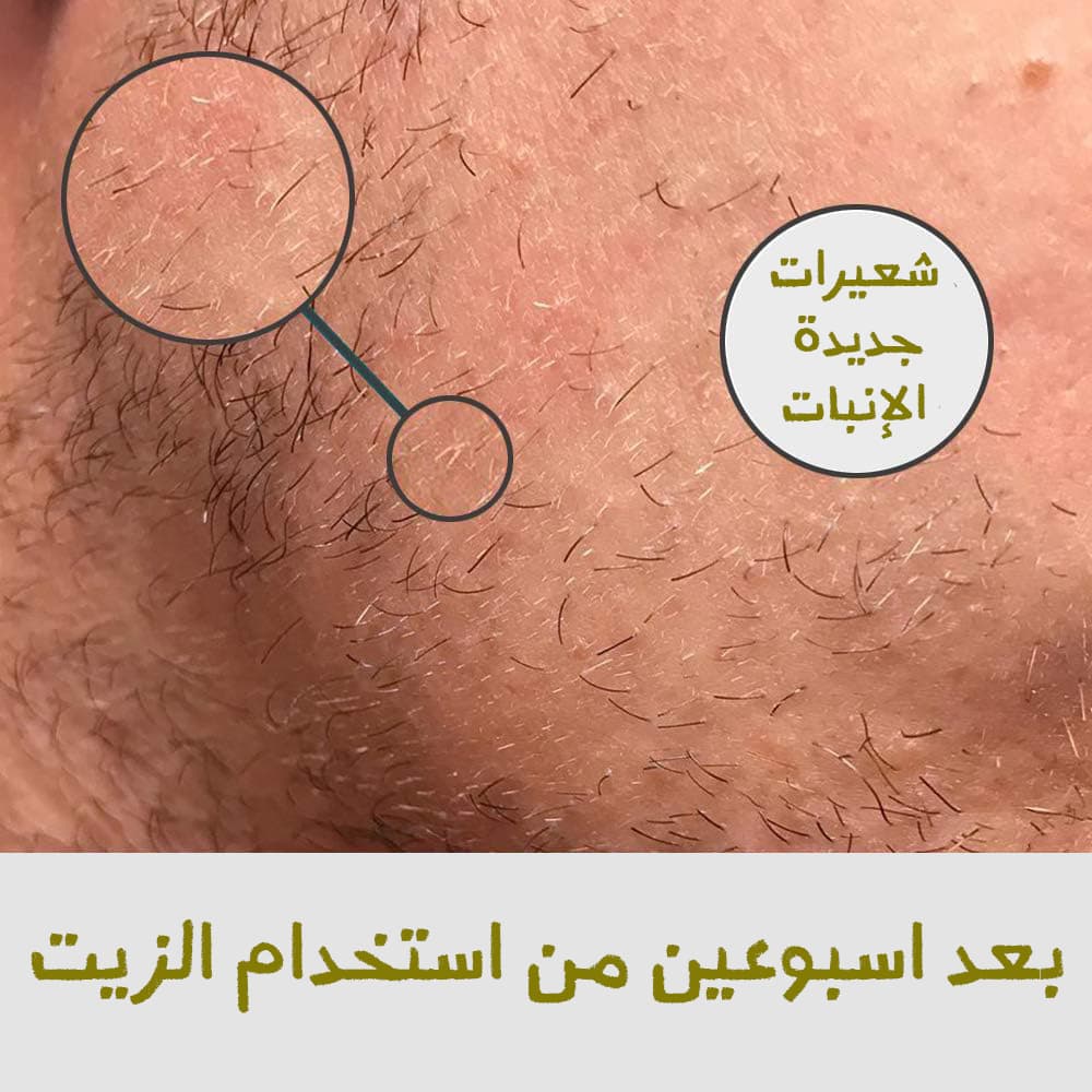 (سر اللحية الجذابة (ماكينة تحديد وتنعيم الشعر الصغيرة + زيت التحفيز هدية - عروض الصحة والجمال - صورة 8